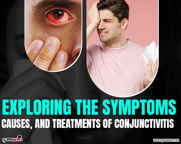 Exploring the Symptoms, Causes, and Treatments of Conjunctivitis